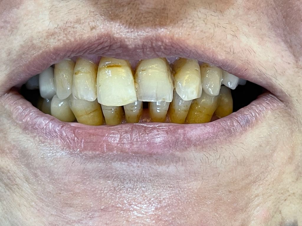 CASE done in a dental clinic