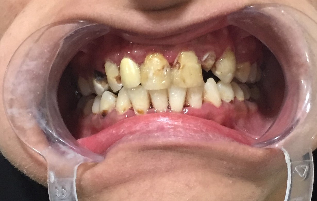 case done at our dental clinic